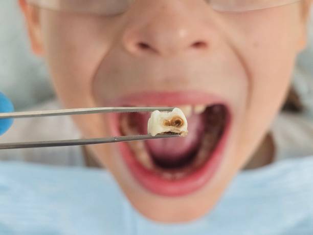 Best Weekend Emergency Dentist in Hillburn, NY